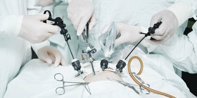 Bedah Minimal Nyeri Dengan Teknik Laparoskopi