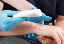 Ketahui Cara Melakukan Pertolongan Pertama Digigit Ular