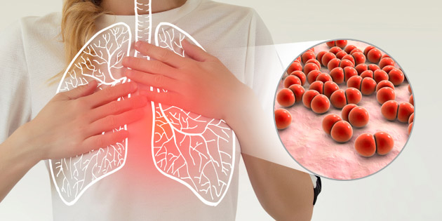 Memahami Pneumonia, Penyebab, Gejala, Diagnosis, Pengobatan hingga Pencegahannya