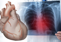 Kenali Penyebab Pembengkakan Jantung