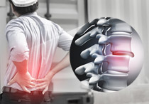 Mengalami Saraf Kejepit? Kenali Penyebab dan Pengobatannya!