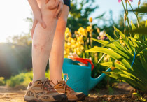 Kenali Penyebab Varises dan Pengobatannya