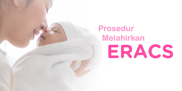 Mengenal Prosedur Kelahiran dengan ERACS, Bumil Wajib Tahu