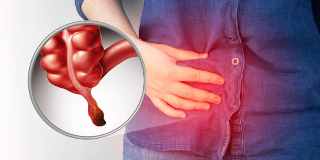 Radang Usus Buntu: Penyebab, Gejala, Cara Mengobati & Mencegahnya