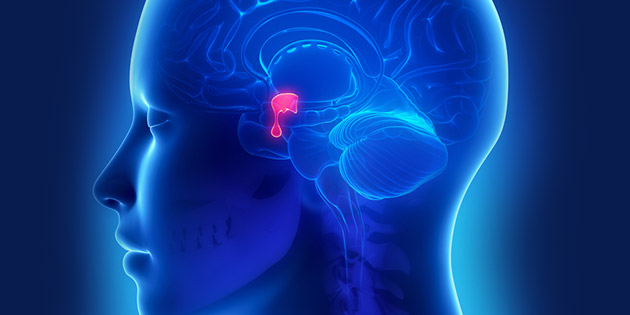 Kenali Gejala dan Penyebab Empty Sella Syndrome