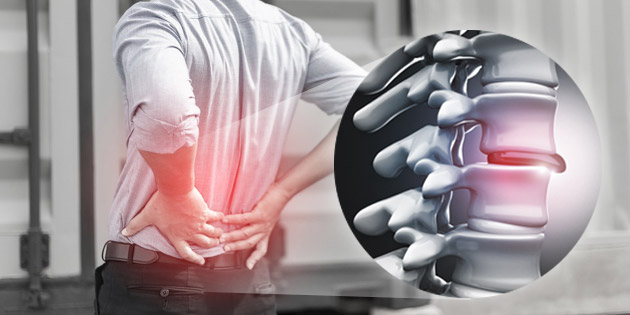 Mengalami Saraf Kejepit? Kenali Penyebab dan Pengobatannya!