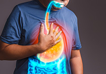 Ketahui Ciri-Ciri Asam Lambung Naik dan Cara Mengatasinya