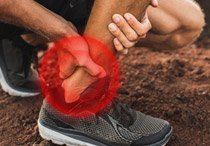 Panduan Lengkap tentang Cedera Tendon Achilles & Penangannya