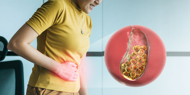 Penyakit Batu Empedu: Penyebab, Gejala, dan Pengobatan