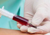 Mengapa Penting Cek Darah Secara Rutin?