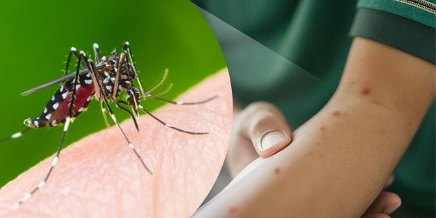 Mengenal Gejala Demam Berdarah, Penyebab, Pengobatan dan Pencegahannya