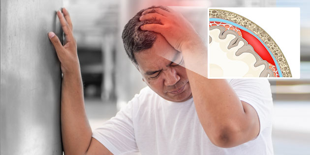 Subdural Hematoma: Penyebab, Gejala, Jenis, dan Cara Mengobati