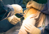 Penyebab Operasi ACL Harus Dilakukan dan Prosedurnya