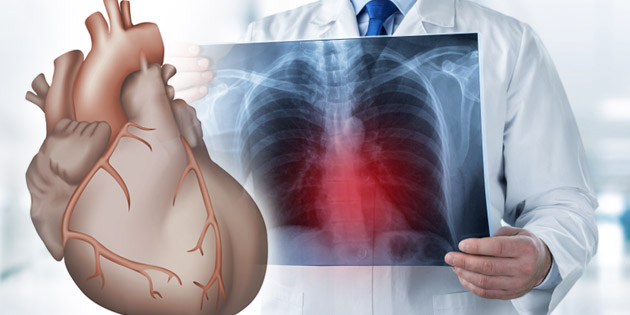 Kenali Penyebab Pembengkakan Jantung