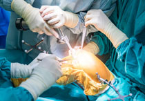 Mengenal Operasi Lutut Mulai dari Definisi, Indikasi dan Prosedurnya