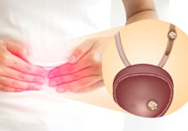 Batu Saluran Kemih: Definisi, Gejala, dan Pengobatan