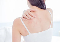 Apa itu Urtikaria atau Biduran?