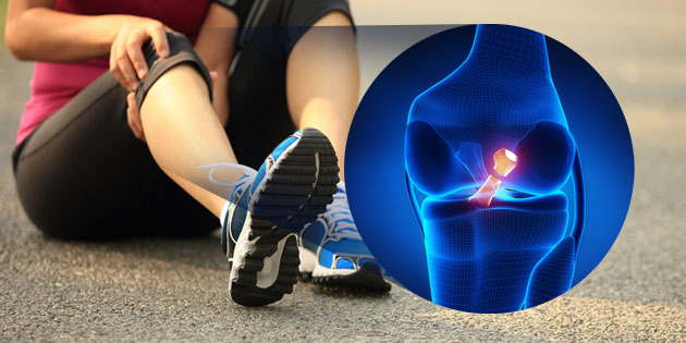 Cedera PCL: Definisi, Penyebab, Gejala, dan Cara Pengobatan