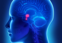 Kenali Gejala dan Penyebab Empty Sella Syndrome