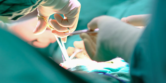 Apa itu Operasi Hernia, Resiko, Prosedur, dan Pemulihannya