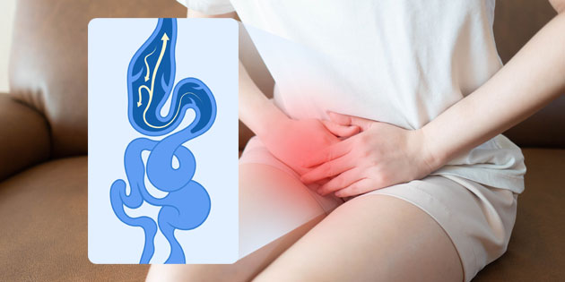 Pelvic Congestion Syndrome: Apa yang Perlu Kita Ketahui dan Bagaimana Cara Pengobatannya