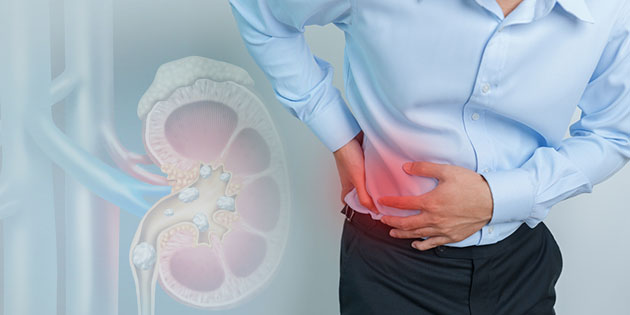 Batu Ginjal: Penyebab, Diagnosa, dan Pengobatan