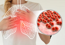 Memahami Pneumonia, Penyebab, Gejala, Diagnosis, Pengobatan hingga Pencegahannya