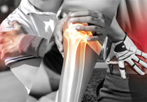 Macam-macam Cedera Olahraga yang Harus Diwaspadai