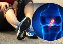 Cedera PCL: Definisi, Penyebab, Gejala, dan Cara Pengobatan