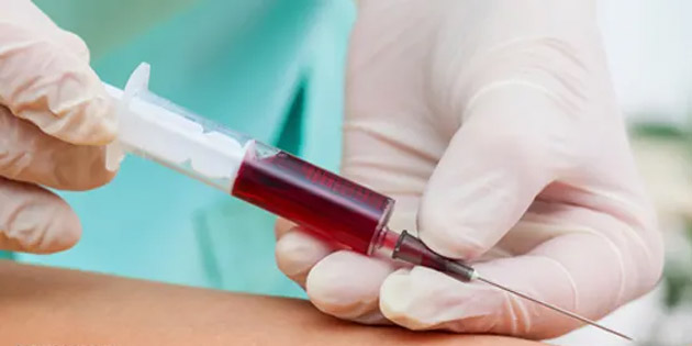 Mengapa Penting Cek Darah Secara Rutin?