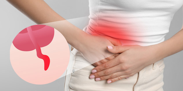 Usus Buntu: Gejala, Penyebab, Cara Mencegah dan Mengobati