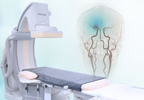 DSA (Digital Subtraction Angiography) - Tindakan Revolusioner dalam Pemeriksaan dan Penanganan Pembuluh Darah