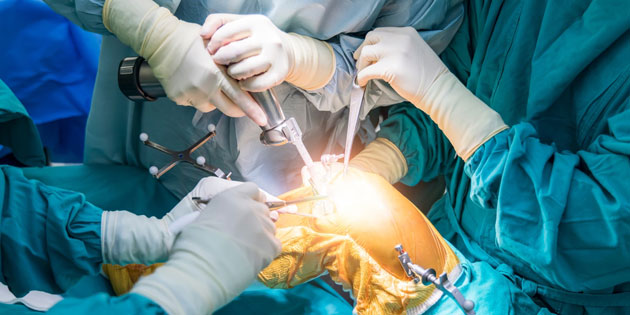 Mengenal Operasi Lutut Mulai dari Definisi, Indikasi dan Prosedurnya