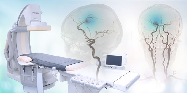 DSA (Digital Subtraction Angiography) - Tindakan Revolusioner dalam Pemeriksaan dan Penanganan Pembuluh Darah